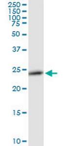 RAB27B Antibody in Western Blot (WB)