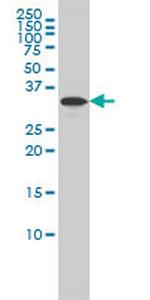 RABGGTB Antibody in Western Blot (WB)