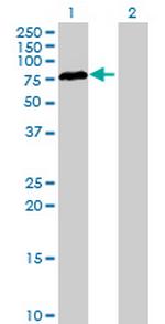 RAD17 Antibody in Western Blot (WB)