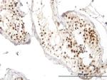 RAD51 Antibody in Immunohistochemistry (Paraffin) (IHC (P))