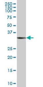 RAD51 Antibody in Western Blot (WB)