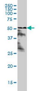 RARA Antibody in Western Blot (WB)