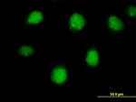 RARB Antibody in Immunocytochemistry (ICC/IF)