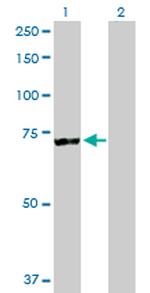 RARS Antibody in Western Blot (WB)