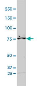 RARS Antibody in Western Blot (WB)