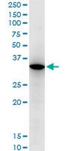 RARRES1 Antibody in Western Blot (WB)