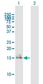 RARRES2 Antibody in Western Blot (WB)