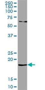 RARRES2 Antibody in Western Blot (WB)