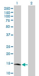 RARRES2 Antibody in Western Blot (WB)