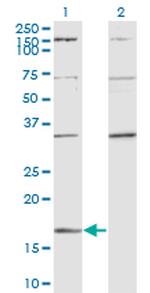 RARRES2 Antibody in Western Blot (WB)