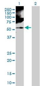 RBMS1 Antibody in Western Blot (WB)