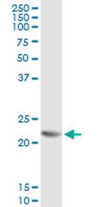 RCV1 Antibody in Immunoprecipitation (IP)