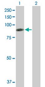 RDX Antibody in Western Blot (WB)