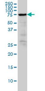 RDX Antibody in Western Blot (WB)