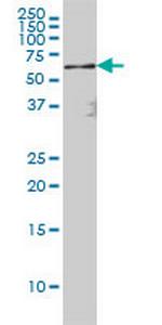 RELA Antibody in Western Blot (WB)