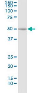 REN Antibody in Western Blot (WB)