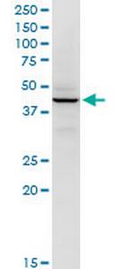 RFC5 Antibody in Western Blot (WB)