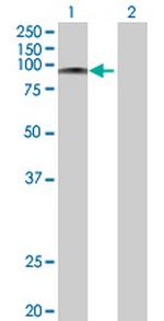 RFX3 Antibody in Western Blot (WB)