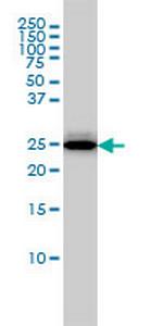 RGS2 Antibody in Western Blot (WB)