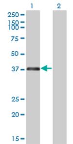 RNF2 Antibody in Western Blot (WB)