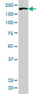 ROCK1 Antibody in Western Blot (WB)