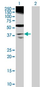 RP2 Antibody in Western Blot (WB)