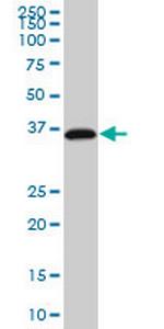 RP2 Antibody in Western Blot (WB)