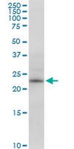 RPE Antibody in Western Blot (WB)