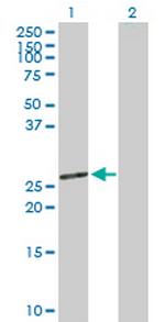 MRPL12 Antibody in Western Blot (WB)