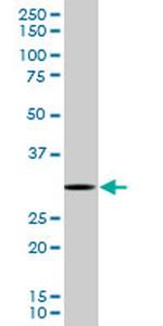 RPS3 Antibody in Western Blot (WB)