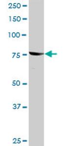 RPS6KA3 Antibody in Western Blot (WB)