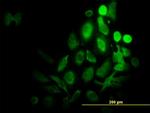 RPS6KB1 Antibody in Immunocytochemistry (ICC/IF)