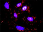 RPS6KB1 Antibody in Proximity Ligation Assay (PLA) (PLA)