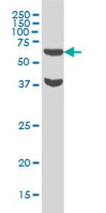 RPS6KB1 Antibody in Western Blot (WB)