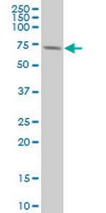 RPS6KB1 Antibody in Western Blot (WB)