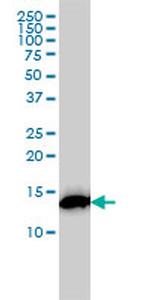 RPS19 Antibody in Western Blot (WB)