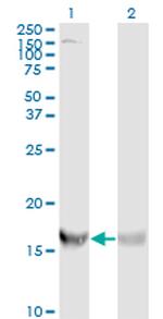 RPS19 Antibody in Western Blot (WB)