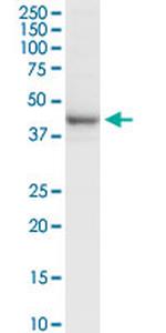 RRM2 Antibody in Western Blot (WB)