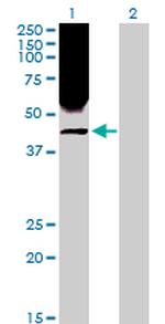 RRM2 Antibody in Western Blot (WB)