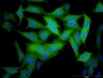 RRM2 Antibody in Immunocytochemistry (ICC/IF)