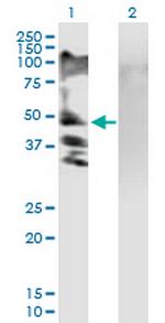 RSC1A1 Antibody in Western Blot (WB)