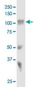 SORT1 Antibody in Western Blot (WB)