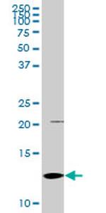 S100A2 Antibody in Western Blot (WB)