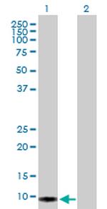 S100A2 Antibody in Western Blot (WB)