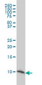 S100A2 Antibody in Western Blot (WB)