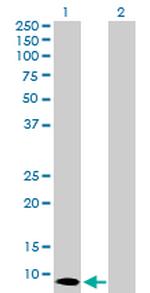 S100A7 Antibody in Western Blot (WB)