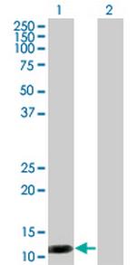 S100A7 Antibody in Western Blot (WB)