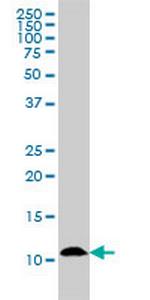 S100A7 Antibody in Western Blot (WB)