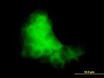 S100A7 Antibody in Immunocytochemistry (ICC/IF)