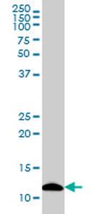 S100A7 Antibody in Western Blot (WB)